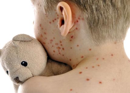 Oms, allarme morbillo: il nodo sono i vaccini