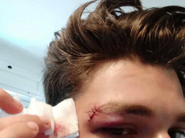 Cinema America di Roma, primi arresti per le aggressioni di giugno. Tutti militanti di Casapound