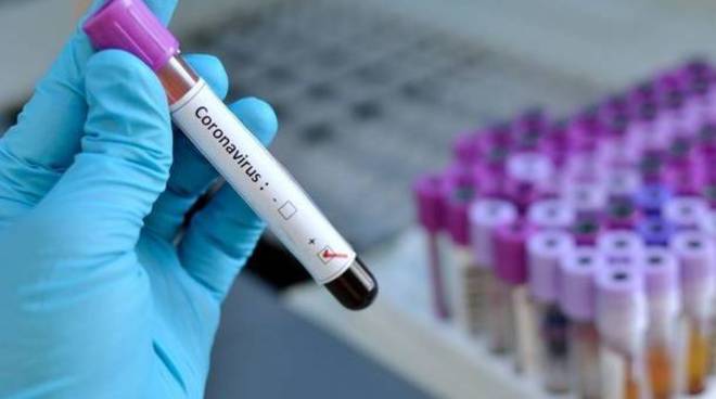 Coronavirus in altalena, tornano ad aumentare i malati (1.127), ma le vittime sono in calo (578)
