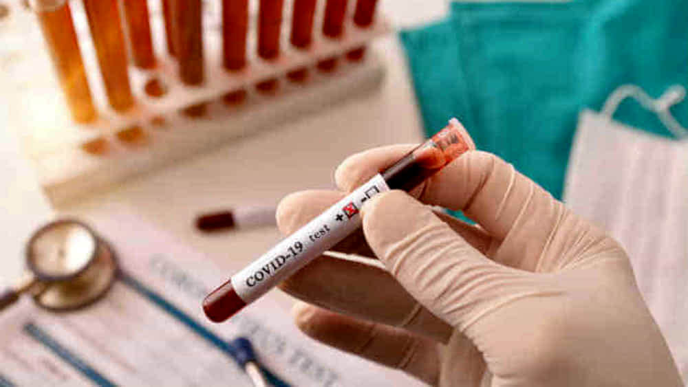 Tre giovani romani in vacanza a Capri positivi al Coronavirus